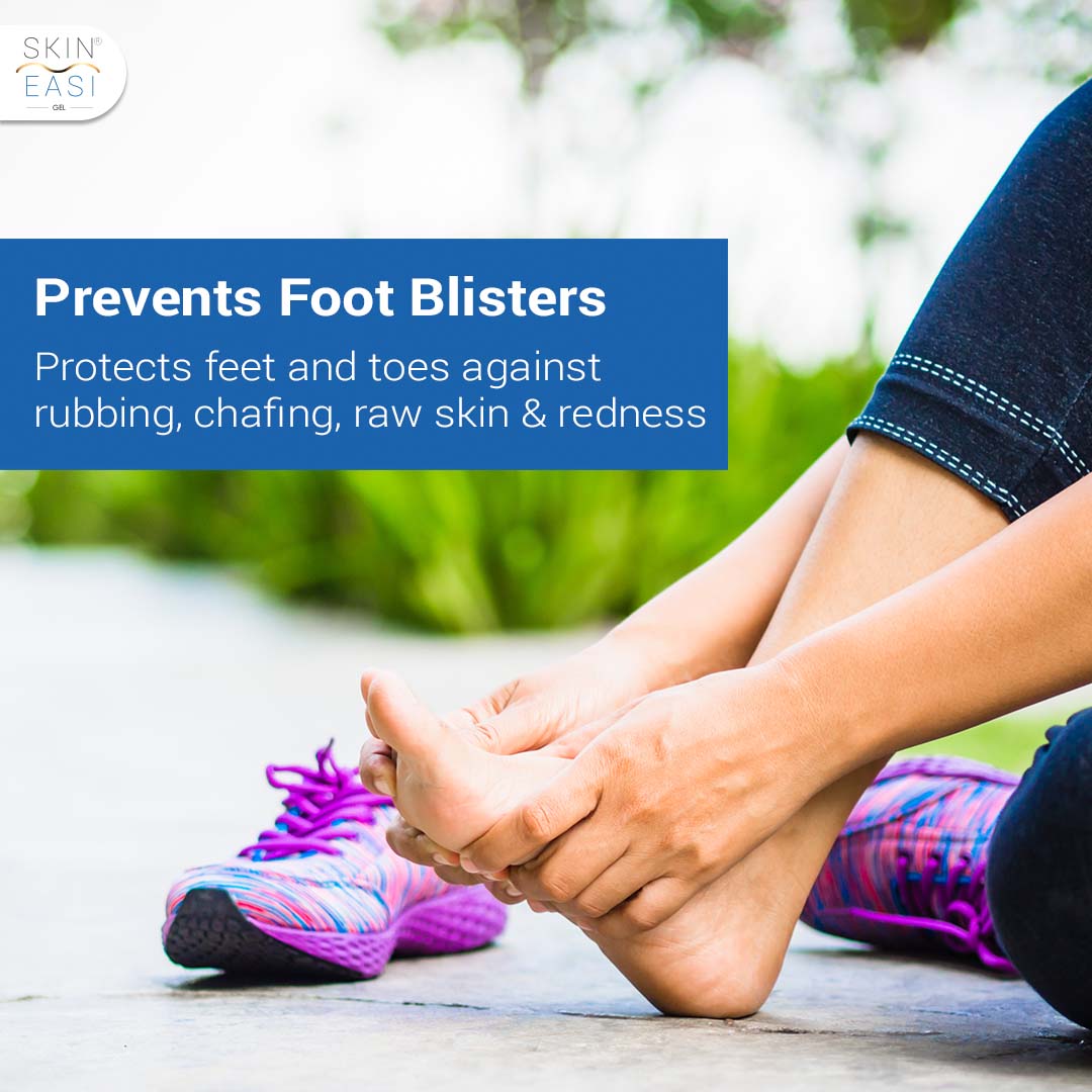 Runners Feet Blisters