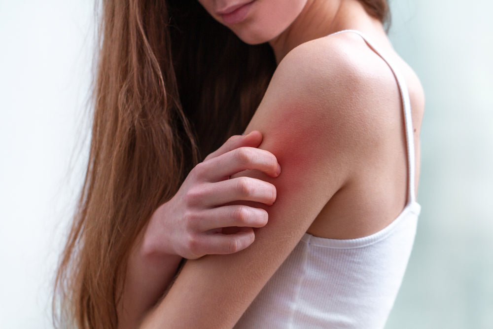 Understanding & Preventing Skin Rashes in Sensitive Areas