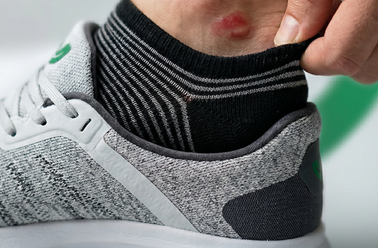 Can Socks Really Prevent Blisters? Here’s the Truth