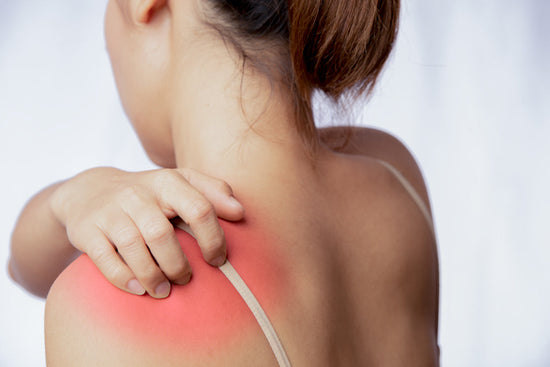 Say Goodbye to Bra Strap Rashes: Summer Skincare Tips for Women