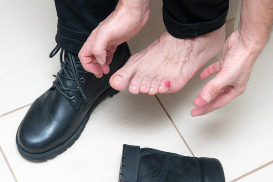 What Causes Shoebites? The Science of Friction Injuries