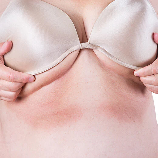 Under Breast Rashes