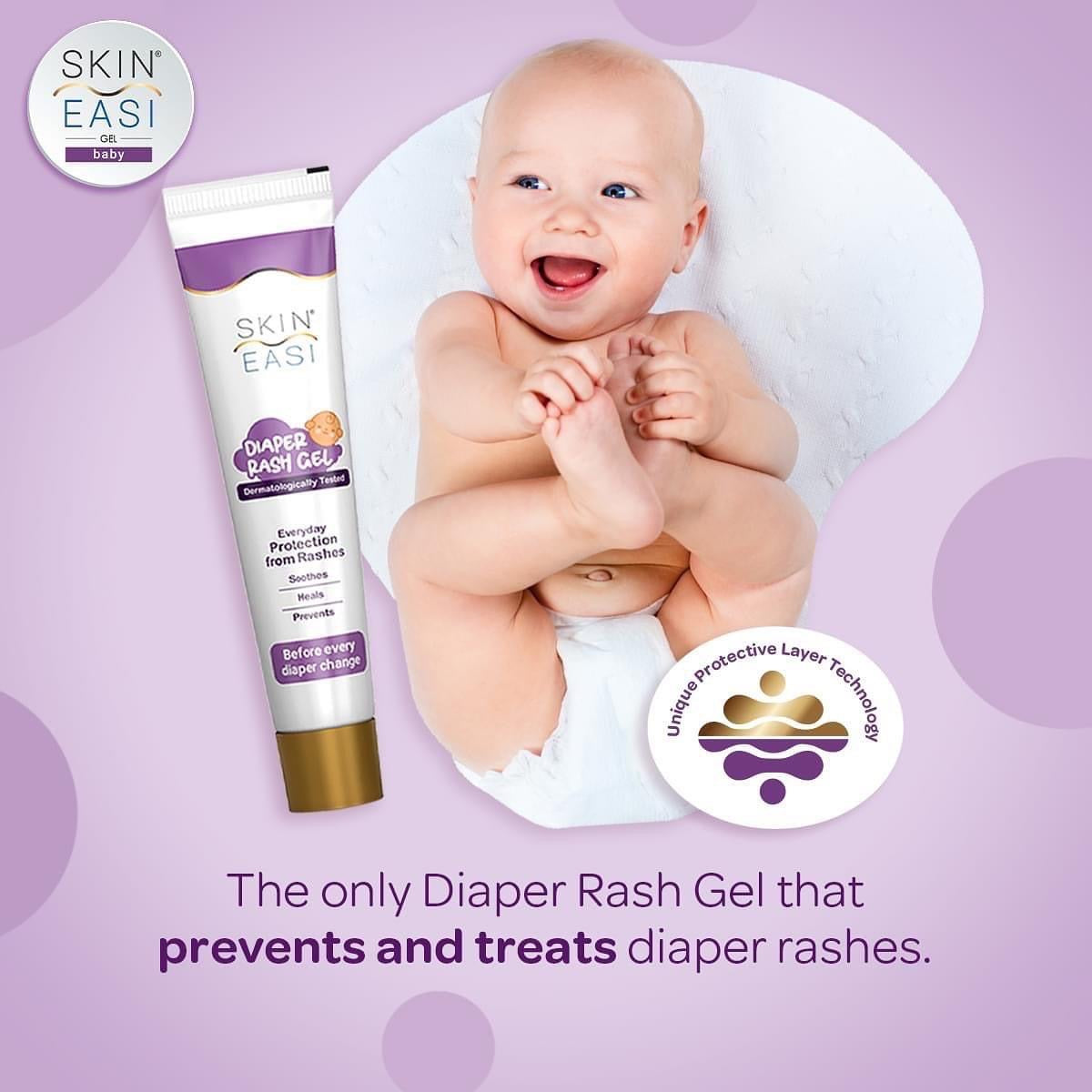 Prevent & Treats Diaper Rashes